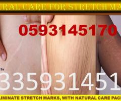 Stretch marks cream