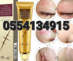 Scar Acne Removal Gel - Image 4