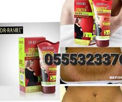 Stretch Mark Cream - Image 2